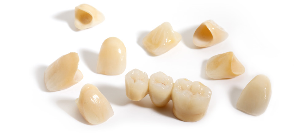 Modellierte Zähne